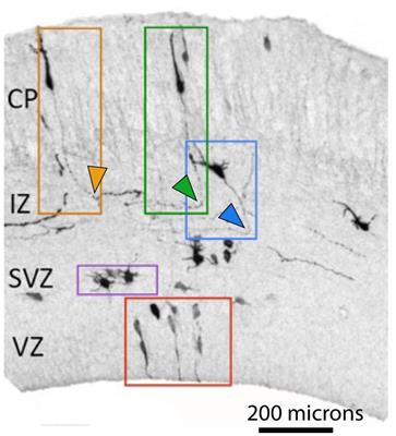 Molecular mechanisms of corpus callosum development: a four-step journey